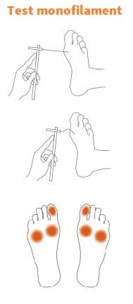 test au monofilament