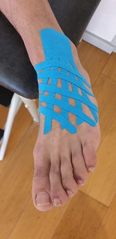 Tapping drainant suite entorse